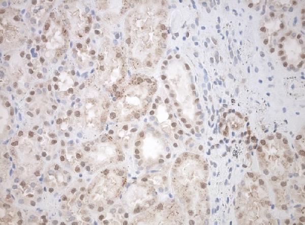 m10709 1 anti snrpb2 mouse monoclonal antibody clone id oti3a7 if testing 5
