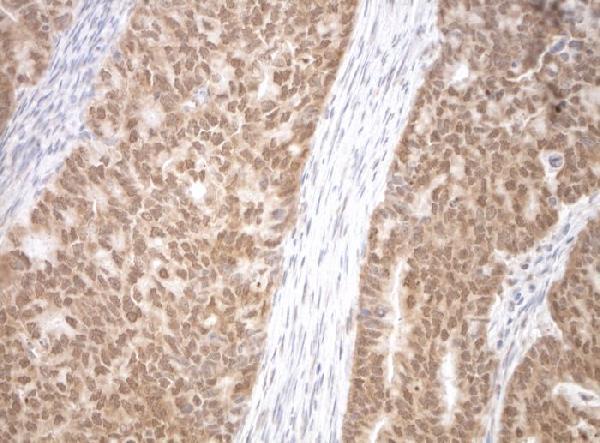 m10709 1 anti snrpb2 mouse monoclonal antibody clone id oti3a7 if testing 6