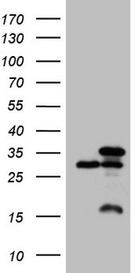 HEK293T cells were transfected with the pCMV6-ENTRY control (Left lane) or pCMV6-ENTRY SNRPB2 (Right lane) cDNA for 48 hrs and lysed