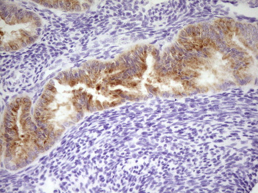 Immunohistochemical staining of paraffin-embedded Human endometrium tissue within the normal limits using anti-LPIN3 mouse monoclonal antibody. (Heat-induced epitope retrieval by 1 mM EDTA in 10mM Tris