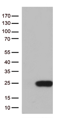 HEK293T cells were transfected with the pCMV6-ENTRY control (Left lane) or pCMV6-ENTRY TSEN15 (Right lane) cDNA for 48 hrs and lysed. Equivalent amounts of cell lysates (5 ug per lane) were separated by SDS-PAGE and immunoblotted with anti-TSEN15 (1:500).