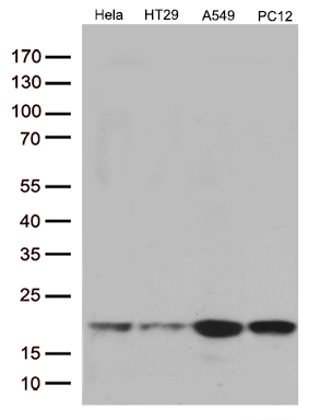 m10736 anti c1orf19 tsen15 mouse monoclonal antibody clone id oti5a3 wb testing 2