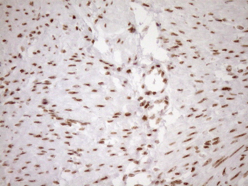 Immunohistochemical staining of paraffin-embedded Human endometrium tissue within the normal limits using anti-EXOSC1 mouse monoclonal antibody
