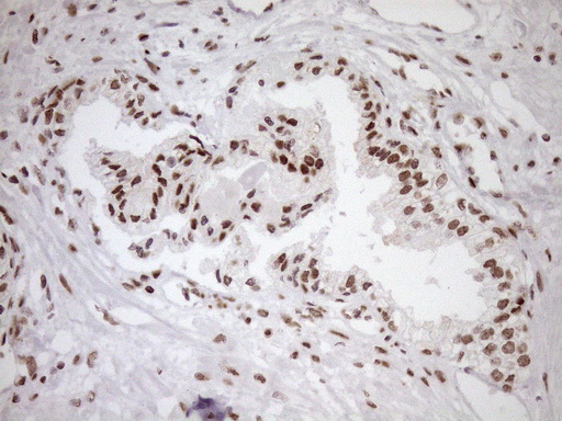 Immunohistochemical staining of paraffin-embedded Human prostate tissue within the normal limits using anti-EXOSC1 mouse monoclonal antibody