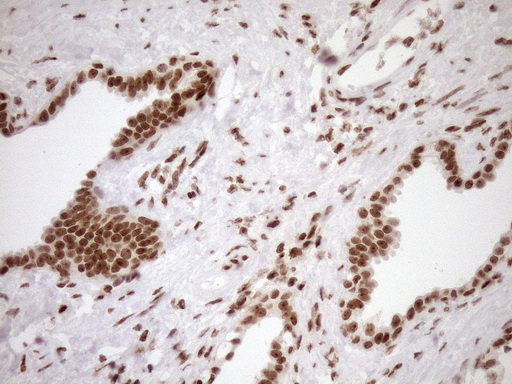 m10811 anti exosc1 mouse monoclonal antibody clone id oti1h9 ihc testing 13