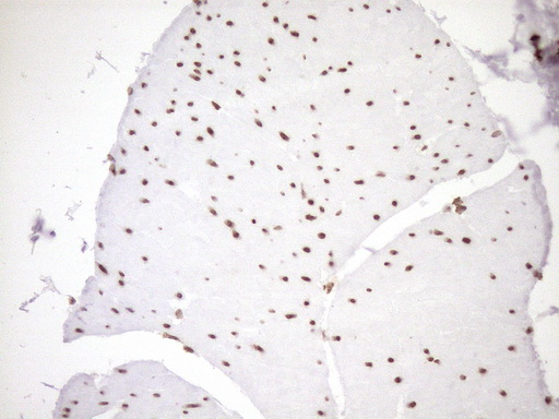 m10811 anti exosc1 mouse monoclonal antibody clone id oti1h9 ihc testing 14
