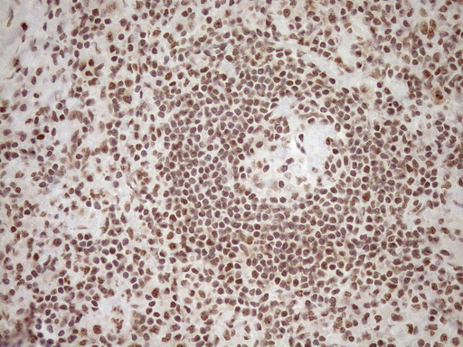 m10811 anti exosc1 mouse monoclonal antibody clone id oti1h9 ihc testing 15