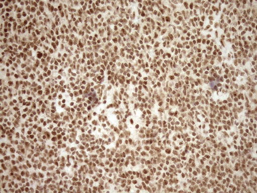 m10811 anti exosc1 mouse monoclonal antibody clone id oti1h9 ihc testing 16