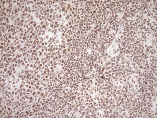 m10811 anti exosc1 mouse monoclonal antibody clone id oti1h9 ihc testing 17