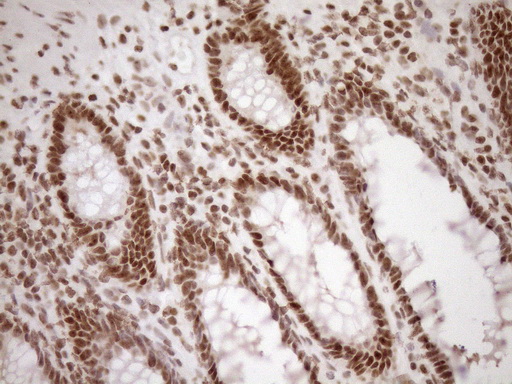 m10811 anti exosc1 mouse monoclonal antibody clone id oti1h9 ihc testing 18