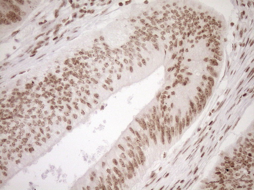 m10811 anti exosc1 mouse monoclonal antibody clone id oti1h9 ihc testing 19
