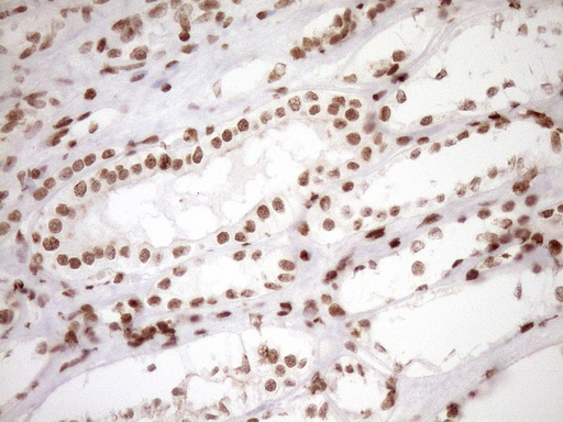 m10811 anti exosc1 mouse monoclonal antibody clone id oti1h9 ihc testing 20