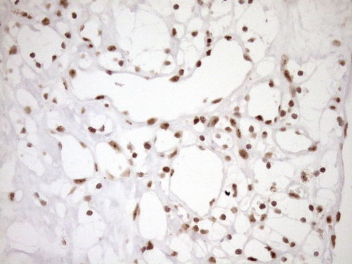 m10811 anti exosc1 mouse monoclonal antibody clone id oti1h9 ihc testing 21