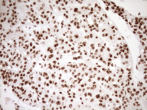 m10811 anti exosc1 mouse monoclonal antibody clone id oti1h9 ihc testing 22
