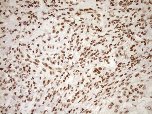 m10811 anti exosc1 mouse monoclonal antibody clone id oti1h9 ihc testing 23