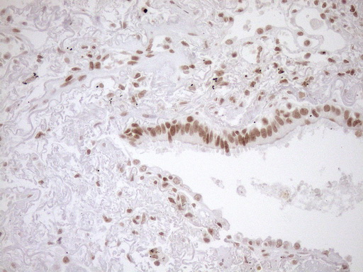 m10811 anti exosc1 mouse monoclonal antibody clone id oti1h9 ihc testing 3