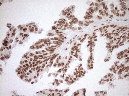 m10811 anti exosc1 mouse monoclonal antibody clone id oti1h9 ihc testing 5