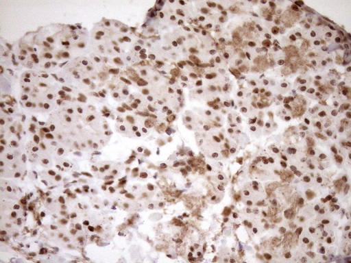 m10811 anti exosc1 mouse monoclonal antibody clone id oti1h9 ihc testing 6