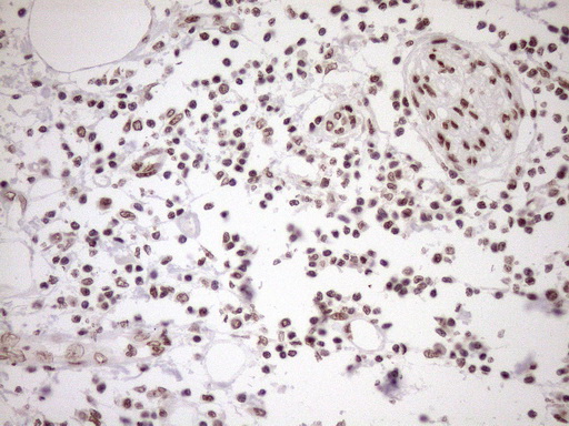 m10811 anti exosc1 mouse monoclonal antibody clone id oti1h9 ihc testing 7