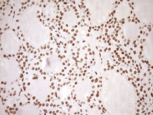 m10811 anti exosc1 mouse monoclonal antibody clone id oti1h9 ihc testing 8