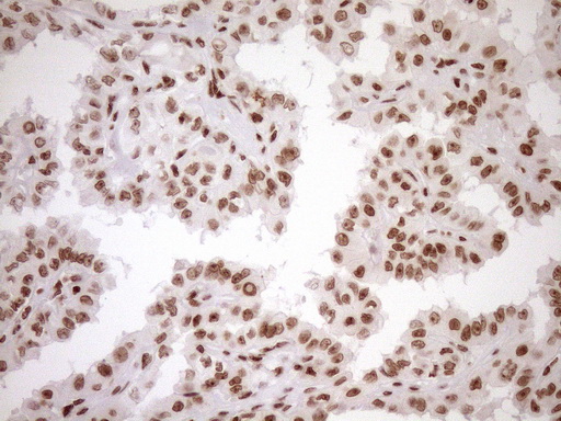 m10811 anti exosc1 mouse monoclonal antibody clone id oti1h9 ihc testing 9
