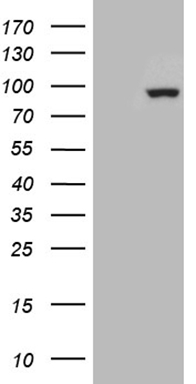 HEK293T cells were transfected with the pCMV6-ENTRY control (Left lane) or pCMV6-ENTRY ZNF175 (Right lane) cDNA for 48 hrs and lysed