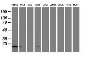 Western blot analysis of extracts (35ug) from 9 different cell lines by using anti-NDUFA7 monoclonal antibody