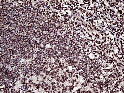 Immunohistochemical staining of paraffin-embedded Human lymph node tissue within the normal limits using anti-L3MBTL3 mouse monoclonal antibody