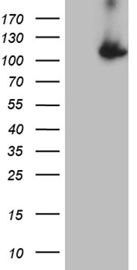 HEK293T cells were transfected with the pCMV6-ENTRY control (Left lane) or pCMV6-ENTRY L3MBTL3 (Right lane) cDNA for 48 hrs and lysed