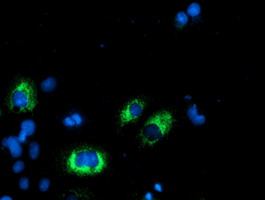 m10870 anti agpat5 mouse monoclonal antibody clone id oti2c4 if testing 7