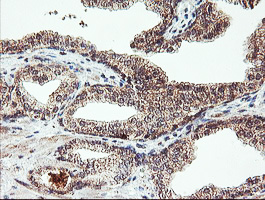 m10870 anti agpat5 mouse monoclonal antibody clone id oti2c4 ihc testing 4