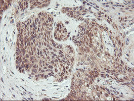m10870 anti agpat5 mouse monoclonal antibody clone id oti2c4 ihc testing 5