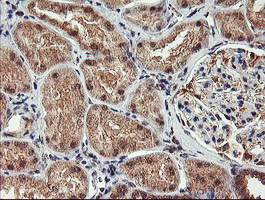 m10870 anti agpat5 mouse monoclonal antibody clone id oti2c4 ihc testing 6