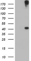HEK293T cells were transfected with the pCMV6-ENTRY control (Left lane) or pCMV6-ENTRY AGPAT5 (Right lane) cDNA for 48 hrs and lysed