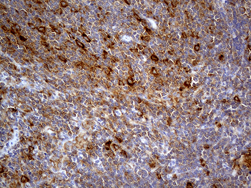 m10873 anti abcf2 mouse monoclonal antibody clone id oti8f4 ihc testing 5