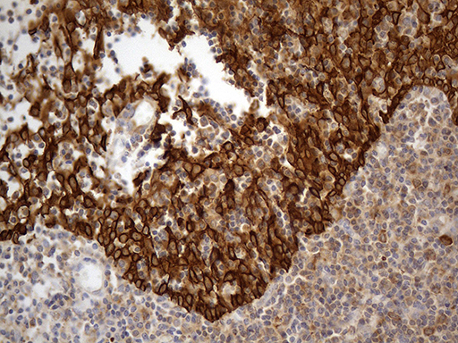 m10873 anti abcf2 mouse monoclonal antibody clone id oti8f4 ihc testing 6