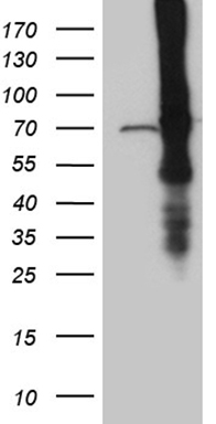 HEK293T cells were transfected with the pCMV6-ENTRY control (Left lane) or pCMV6-ENTRY ABCF2 (Right lane) cDNA for 48 hrs and lysed