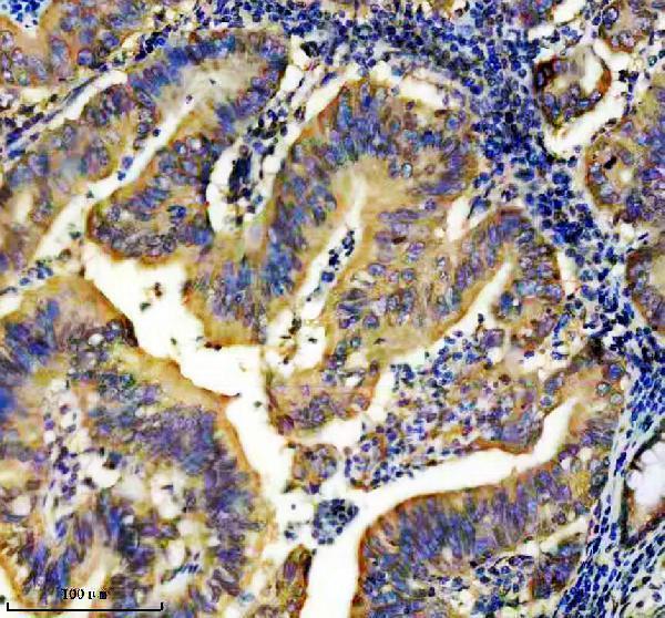 IHC analysis of EEF1G using anti-EEF1G antibody (M10881)