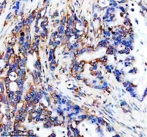IHC analysis of EEF1G using anti-EEF1G antibody (M10881)