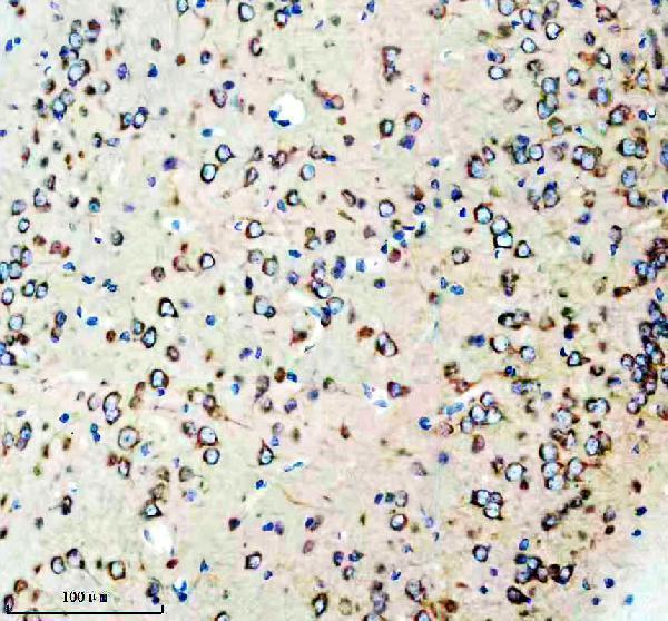 m10881 eef1g primary antibodies ihc testing 3