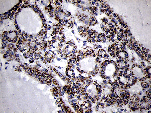 m10898 anti mrpl44 mouse monoclonal antibody clone id oti3h5 ihc testing 3