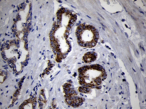 m10898 anti mrpl44 mouse monoclonal antibody clone id oti3h5 ihc testing 5