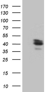 HEK293T cells were transfected with the pCMV6-ENTRY control (Left lane) or pCMV6-ENTRY BRMS1L (Right lane) cDNA for 48 hrs and lysed. Equivalent amounts of cell lysates (5 ug per lane) were separated by SDS-PAGE and immunoblotted with anti-BRMS1.