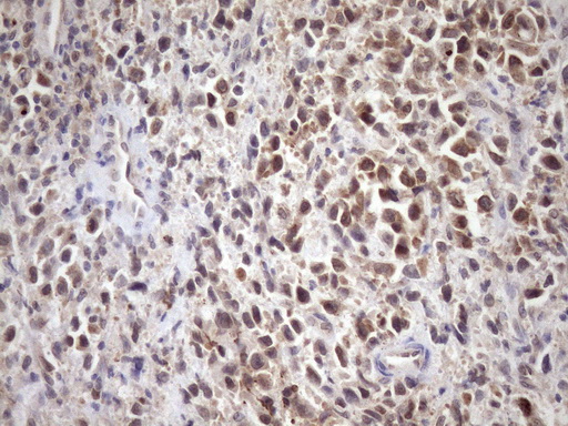 m10901 anti scmh1 mouse monoclonal antibody clone id oti5e6 ihc testing 4