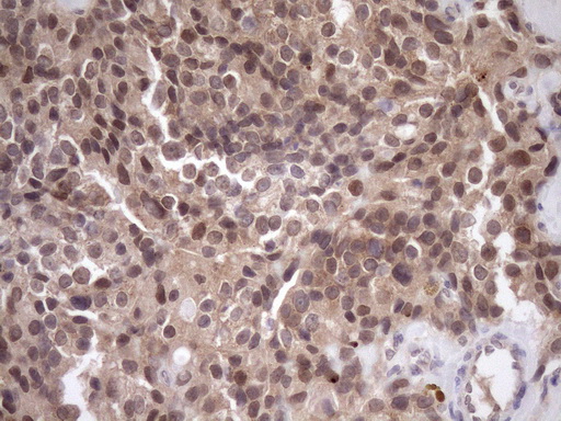 m10901 anti scmh1 mouse monoclonal antibody clone id oti5e6 ihc testing 5
