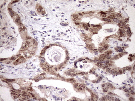 m10901 anti scmh1 mouse monoclonal antibody clone id oti5e6 ihc testing 6