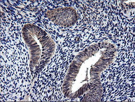 Immunohistochemical staining of paraffin-embedded Human endometrium tissue within the normal limits using anti-NEK11 mouse monoclonal antibody
