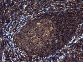 m10929 anti nek11 mouse monoclonal antibody clone id oti5d9 ihc testing 5
