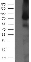 HEK293T cells were transfected with the pCMV6-ENTRY control (Left lane) or pCMV6-ENTRY NEK11 (Right lane) cDNA for 48 hrs and lysed