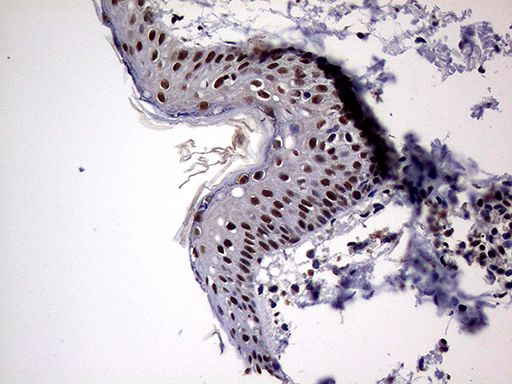 m10933 anti pasd5 npas1 mouse monoclonal antibody clone id oti4c10 ihc testing 2